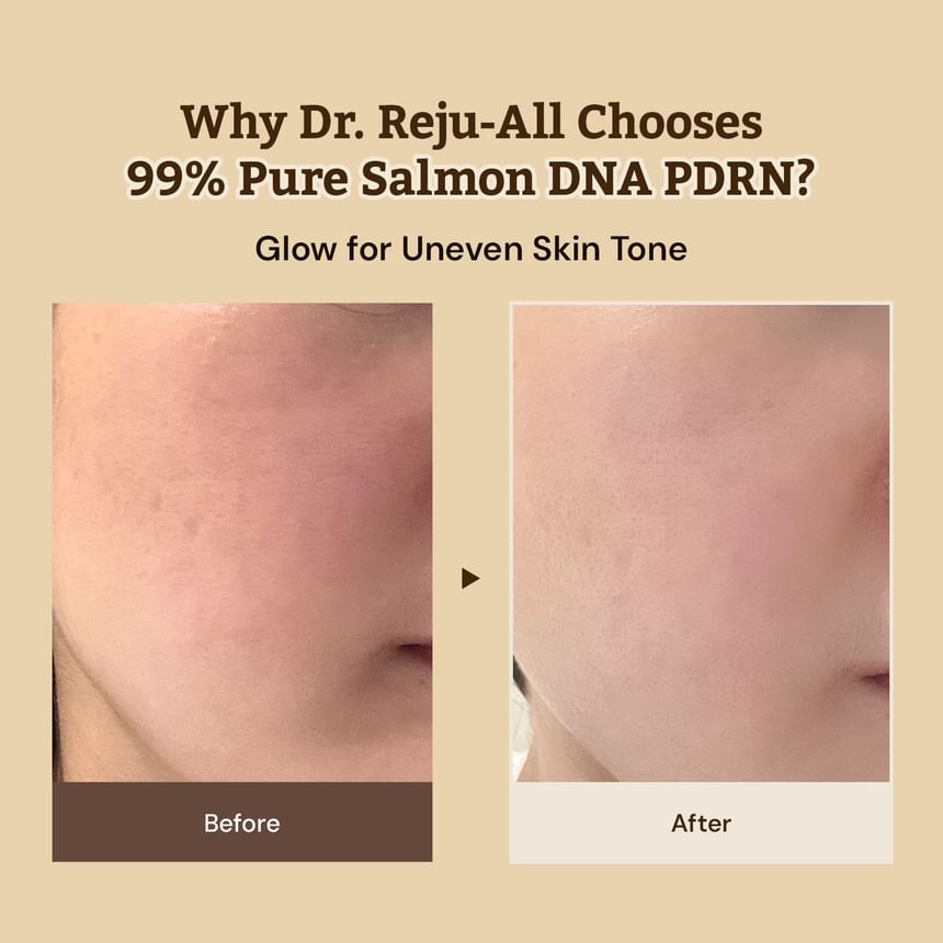 Advanced PDRN Rejuvenating Cream 20ml
