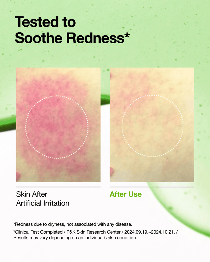 Azelaic Acid 10 Hyaluron Redness Soothing Serum 30ml