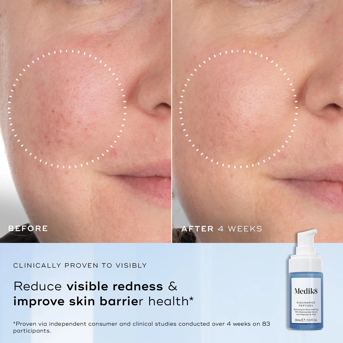 Niacinamide Peptides